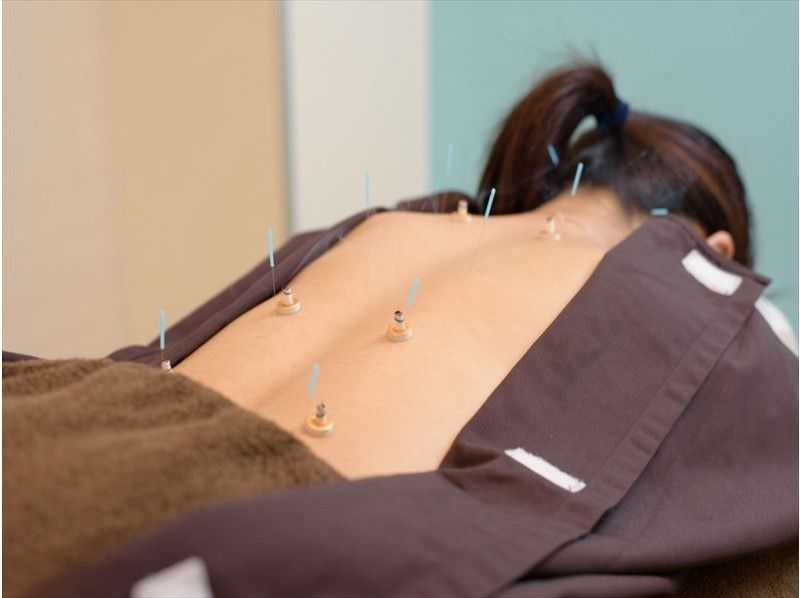 【広島県・広島市中区・日本伝統のはりとお灸】広島の真ん中で癒しのはりとお灸