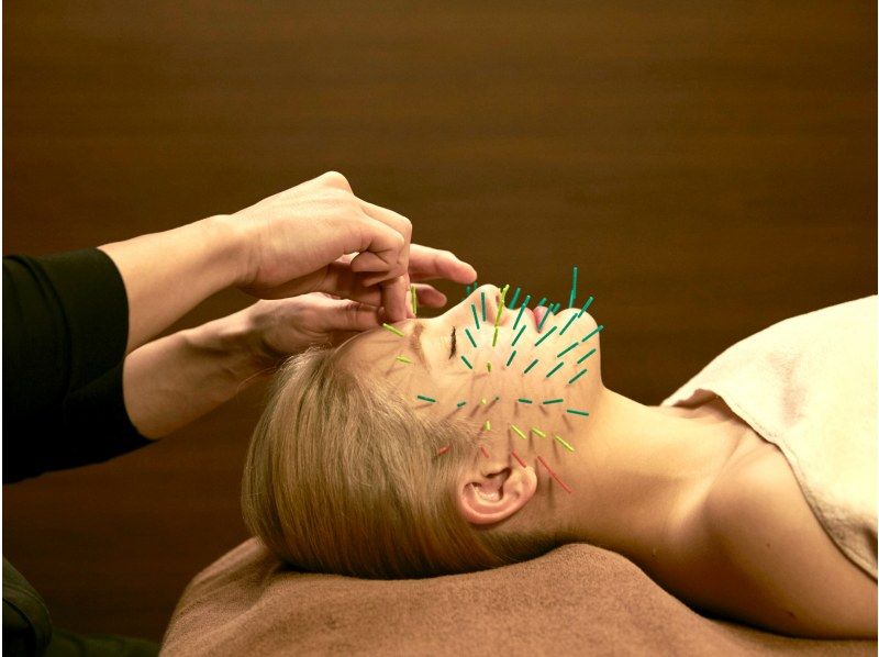 [Tokyo/Shibuya] KADOMORI hedgehog cosmetic acupuncture that can only be received in Japanの紹介画像