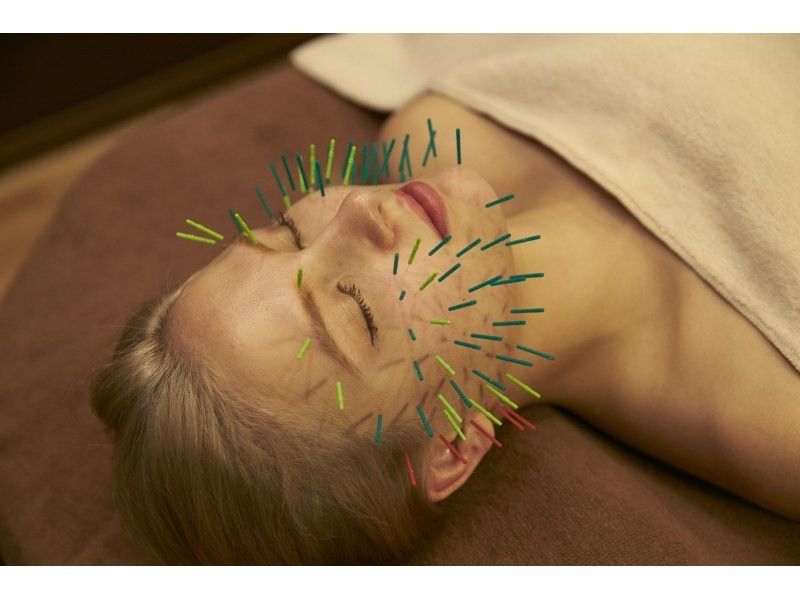 [Nagoya / Meieki Immediate] Those who are concerned about lift-up and swelling "Hedgehog beauty acupuncture"の紹介画像