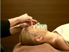 <Treatment> Beauty acupuncture using 10 needles